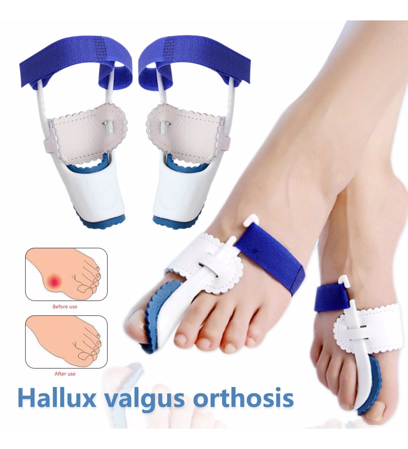 HALLUX VALGUS GECE ATELİ ÇİFTLİ 